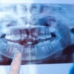 ECU Dentistry: Keeping your smile